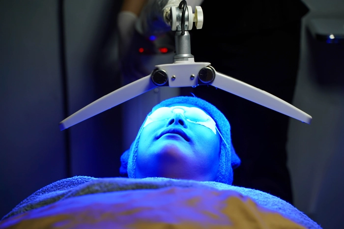 photo dynamic treatment blue light helps treat acne inflammation kill bacteria reduce rash