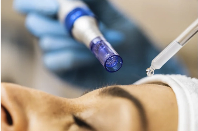 microneedle with sculptra aesthetic spa treatment