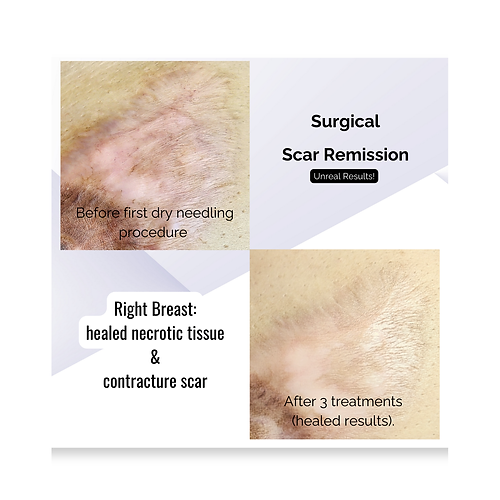 Permanent Makeup and Paramedical Tattoo Services in Delray Beach Florida