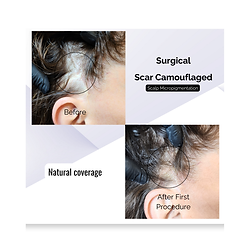 Permanent Makeup and Paramedical Tattoo Services in Delray Beach Florida