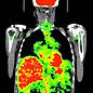 NuclearMD Logo, Nuclear Medicine Scan, PET-CT imaging - nuclear medicine courses to prep for exam