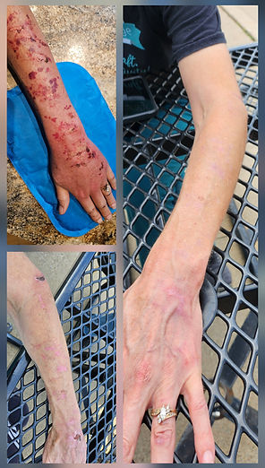 Wounds on an arm, showing progression on healing after using calendula salve