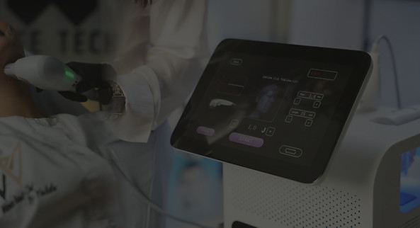 HIFU full face - mini face lift