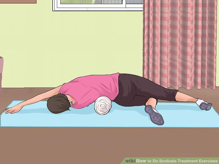 Useful Exercise & Stretches to Help Reduce Pain from Scoliosis