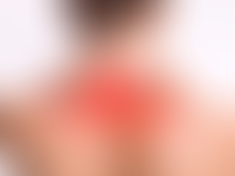 Person hält sich den schmerzenden Nacken, Bereich gerötet markiert – typische Nackenschmerzen mit Hinweis auf Ursachen und passende Übungen.