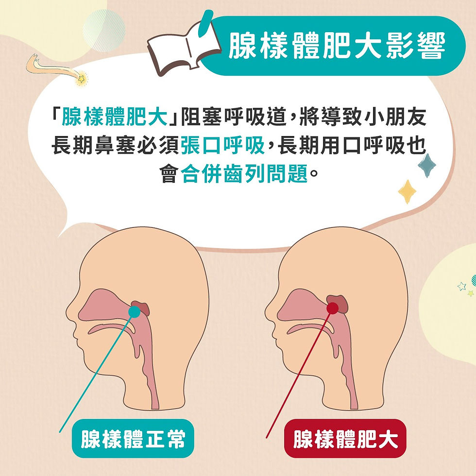 寶貝牙牙醫診所-腺樣體肥大