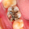 Safe Mercury Removal in Qingpu