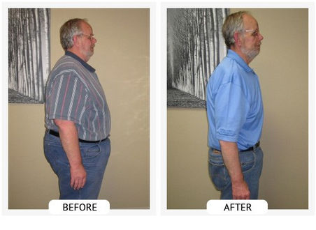 Bill has lost 160 lbs and 73 inches with the holistic weight loss program!
