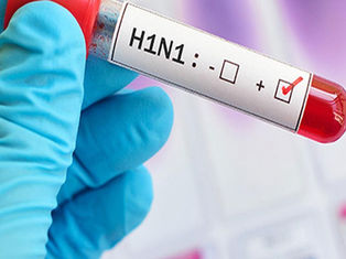 ಕರ್ನಾಟಕದಲ್ಲಿ H1N1 ಮತ್ತು ಇನ್ಫ್ಲುಯೆನ್ಸ ಪ್ರಕರಣ ಹೆಚ್ಚಳ