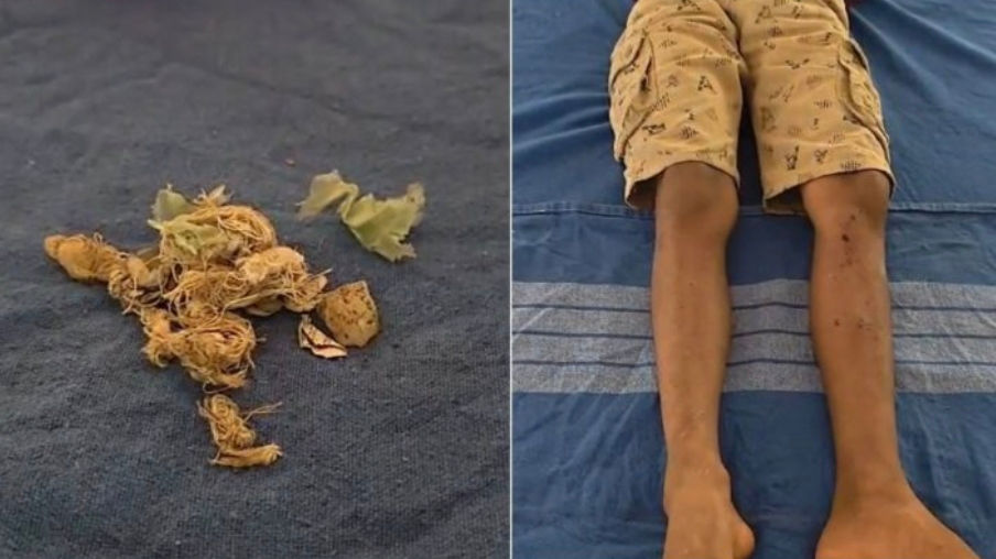 ಬೆಳ್ತಂಗಡಿ ಬಂದಾರು ಗ್ರಾಮದಲ್ಲಿ ಸ್ಫೋಟ: ಕ್ರಿಕೆಟ್ ಆಡುತ್ತಿದ್ದ 11 ವರ್ಷದ ಬಾಲಕ ಗಾಯ