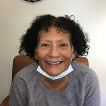 Bilateral Ocular Prostheses 