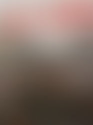 Variations Anti - CPE