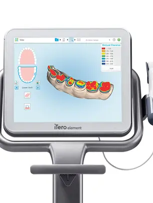 Scan Intraoral: Como a Tecnologia Digital Está a Substituir as Moldagens Tradicionais