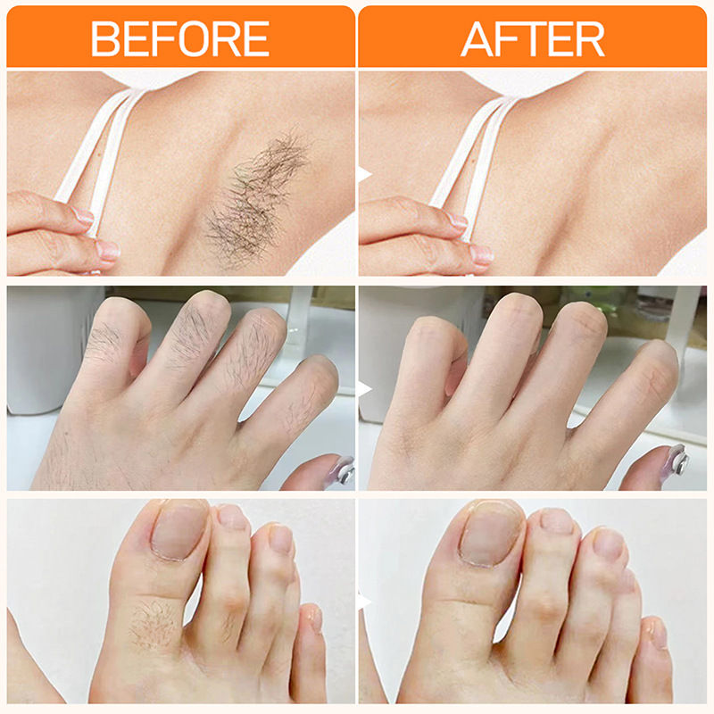 Thumbnail: JoyPretty hair removal cream for facial and body hair care 20g