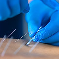 close-up-of-a-needle-and-hands-of-physio