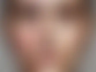¿Cómo eliminar el acné rápido?