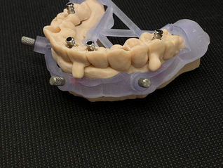 Ghid Chirurgical all on 6