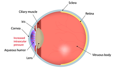 Glaucoma-2.png