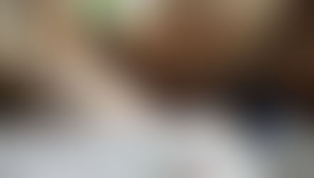 Total Knee Replacement Series: Early Stages of Recovery