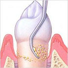 valencia dentista valenciadentista dentista 24h valencia dentista alameda valencia dentista abierto hoy valencia blanqueamiento dental valencia