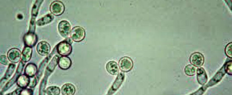 candidaalbicans.jpg