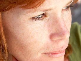 Redhead
