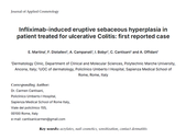 Infliximab-induced eruptive sebaceous hyperplasia inpatient treated for ulcerative Colitis.