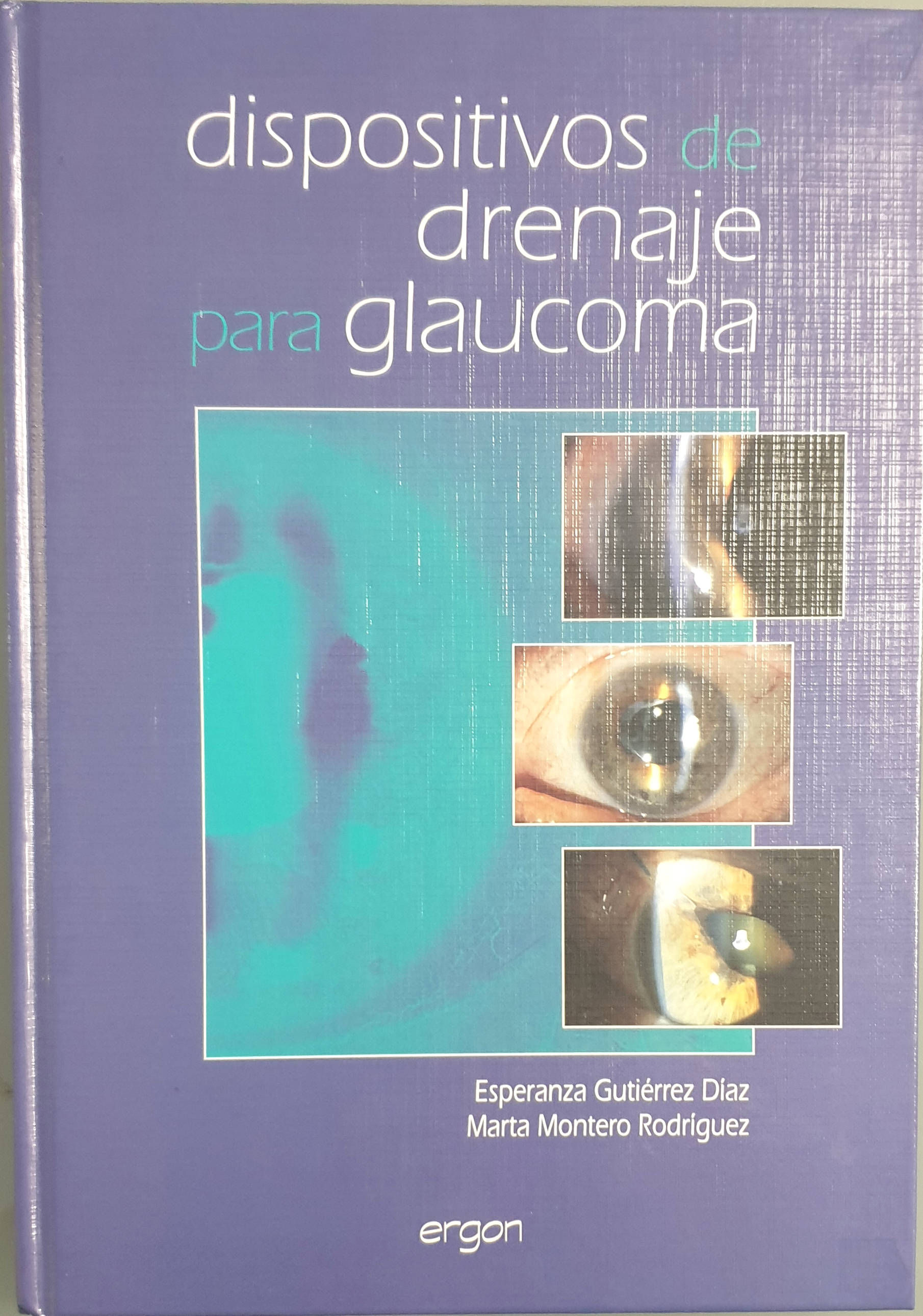Dispositivos de drenaje para glaucoma | Gutiérrez, Esperanza-Montero, Marta | Los Libros del Abuelo, tu librería solidaria