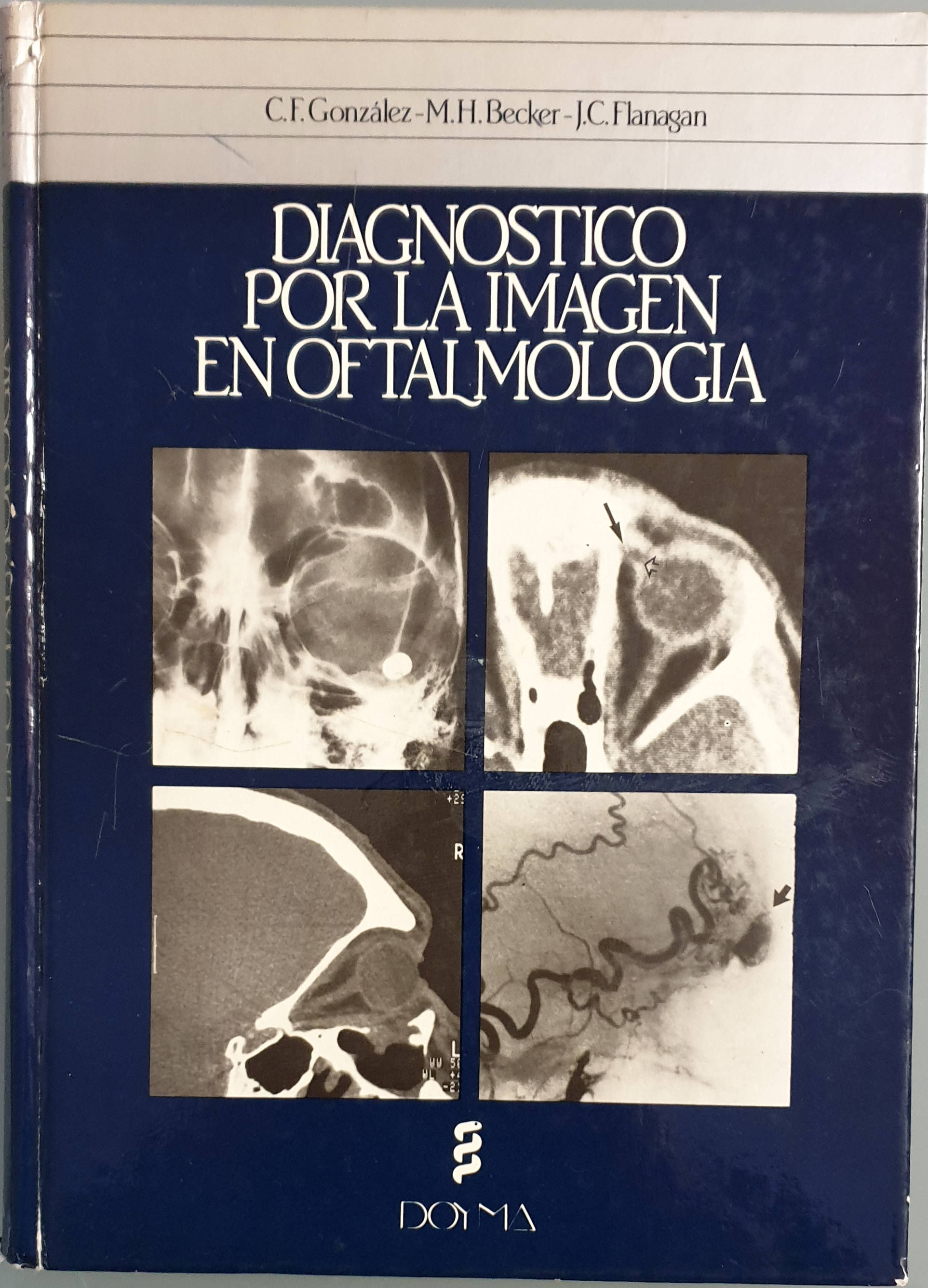 Diagnóstico por la imagen en oftalmología | González, C.F.-Becker, M.H.-Flanagan, J.C. | Los Libros del Abuelo, tu librería