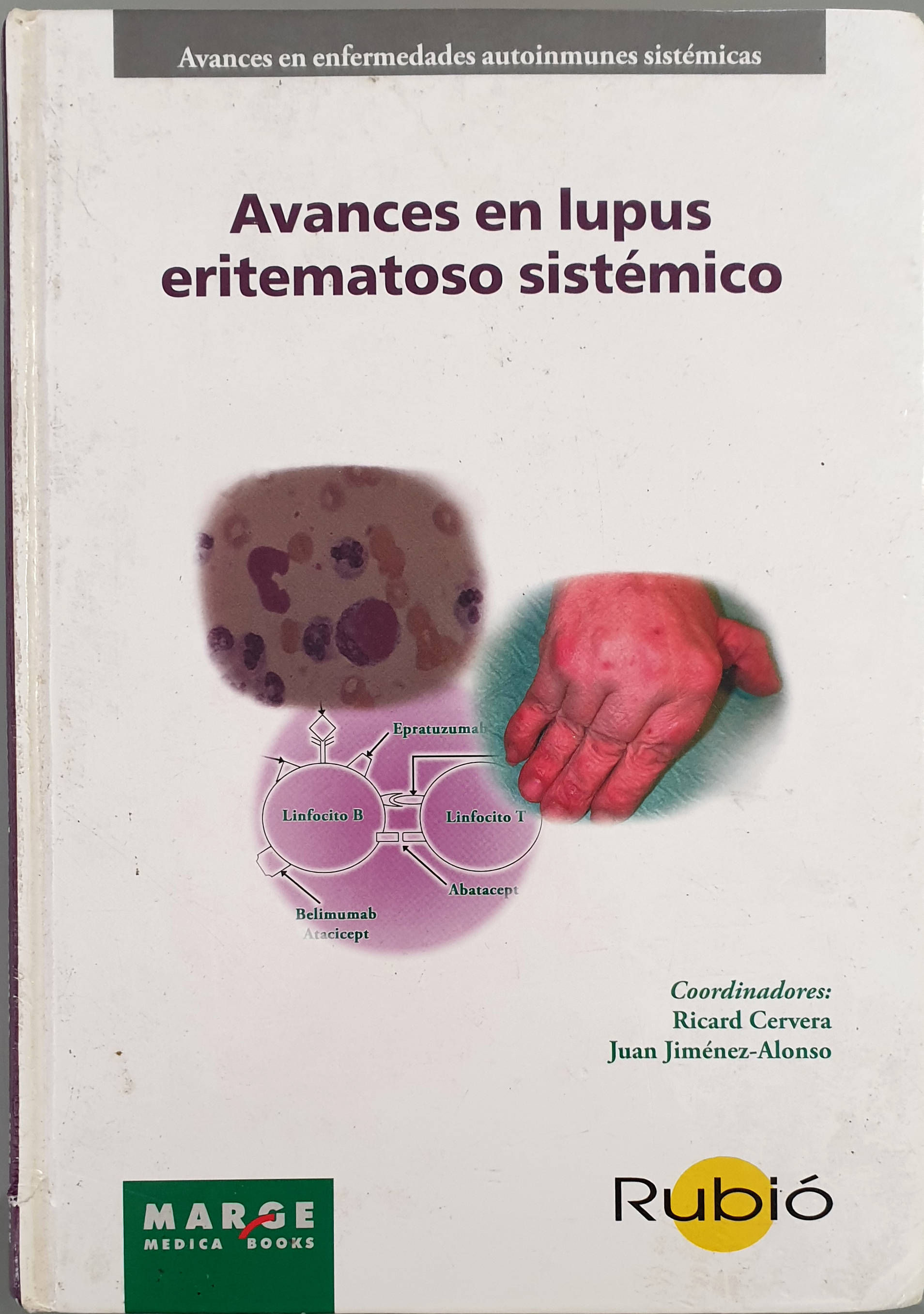 Avances en lupus eritematoso sistémico | Cervera, Ricard (Dir.