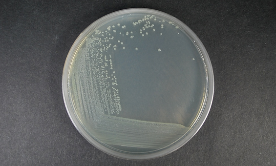 Coliform detect | My Site 1