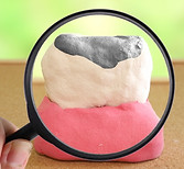 歯の模型