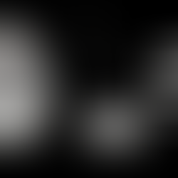 Moon in Cancer - November 18, 2024