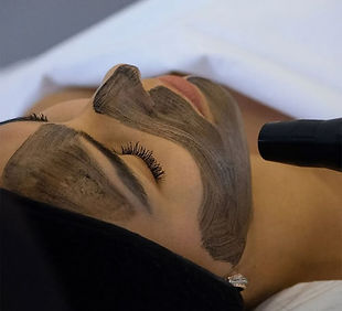 All About the Carbon Peel_ Process, Effects, and Costs.jpeg