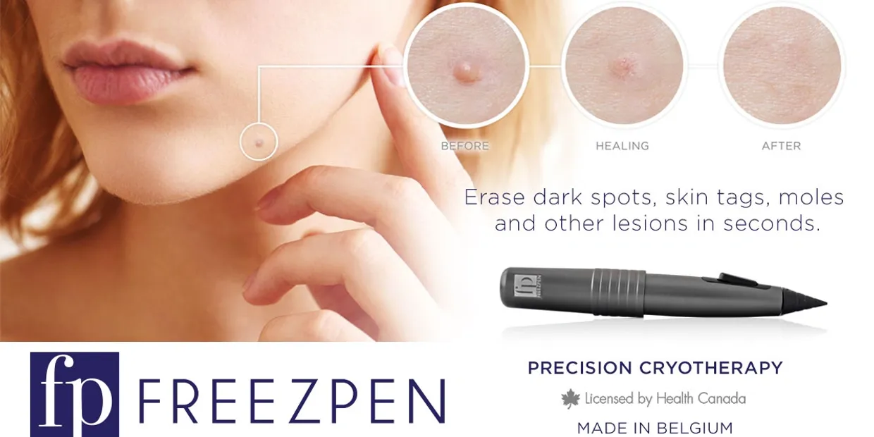freezepen.webp