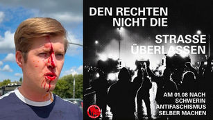 Blutige Gewalt auf offener Straße: Antifa-Attentat auf AfD-Jugendfunktionär erschüttert Schwerin