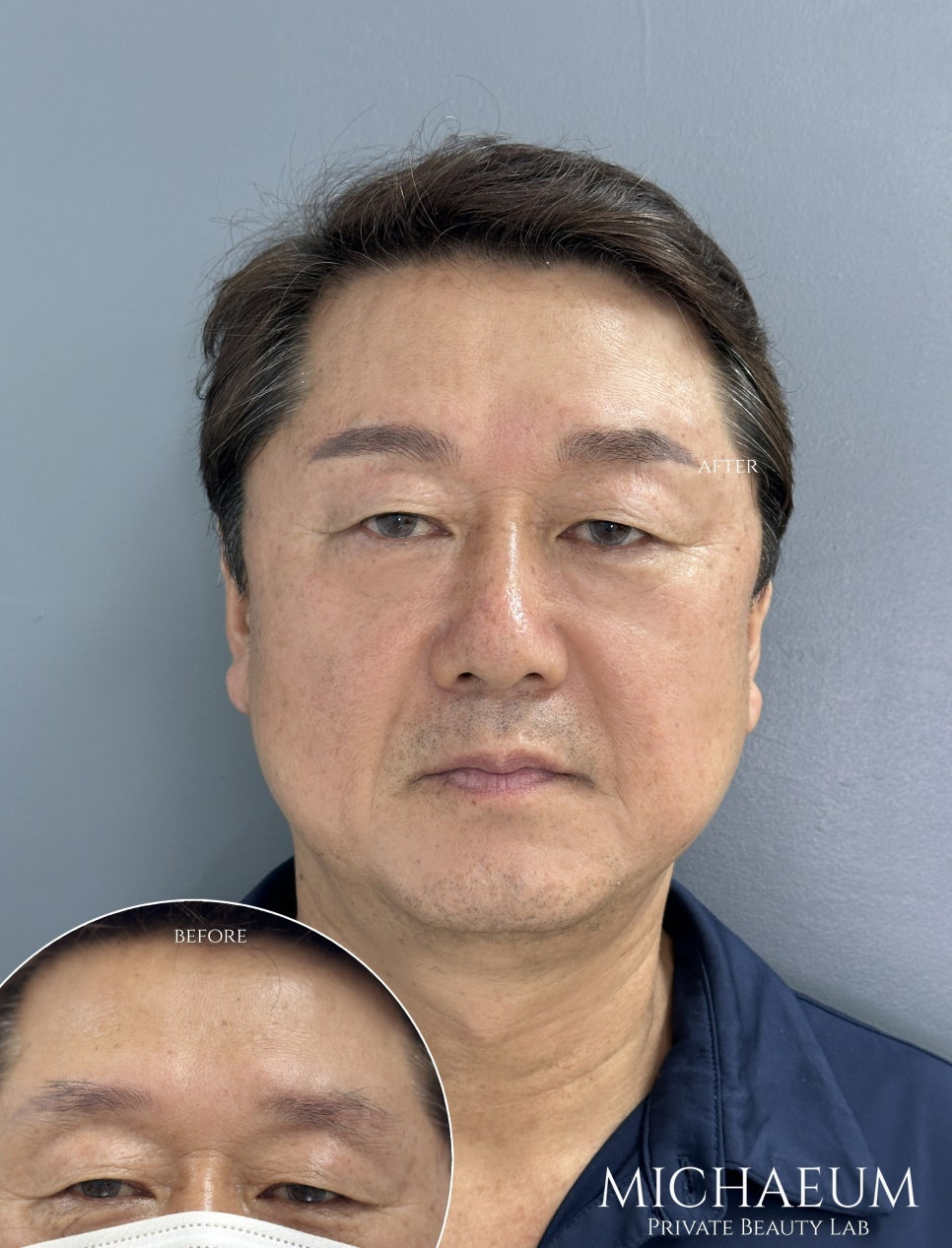 성수역눈썹문신, 청량리눈썹문신, 강남눈썹문신, 헤어스트록잘하는곳,눈썹문신부작용