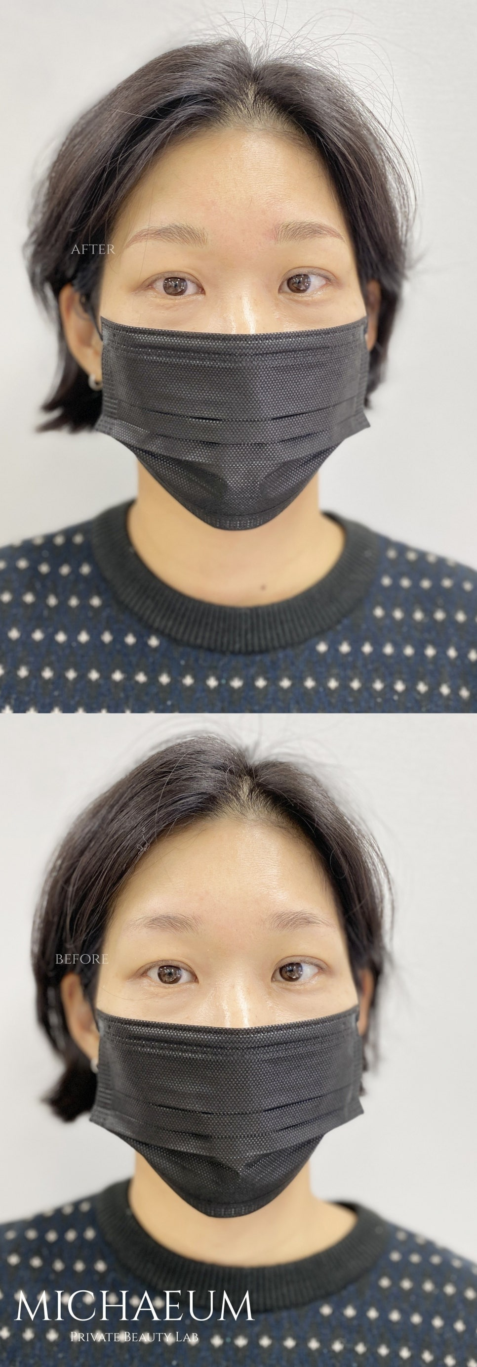 답십리에서 눈썹문신 잘하는 곳을 찾고 있다면, 무엇을 봐야 할까요?