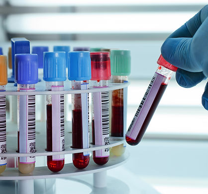 Bloos samples for teting