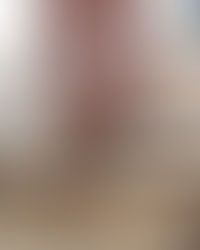 HOW COMMON ARE BED BUGS IN THE US? 