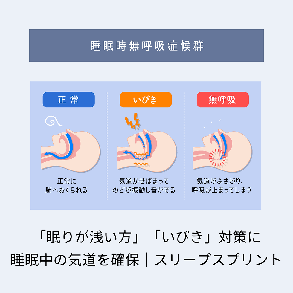 正常な気道といびき時の気道の狭窄、無呼吸時の気道閉塞を比較した図解