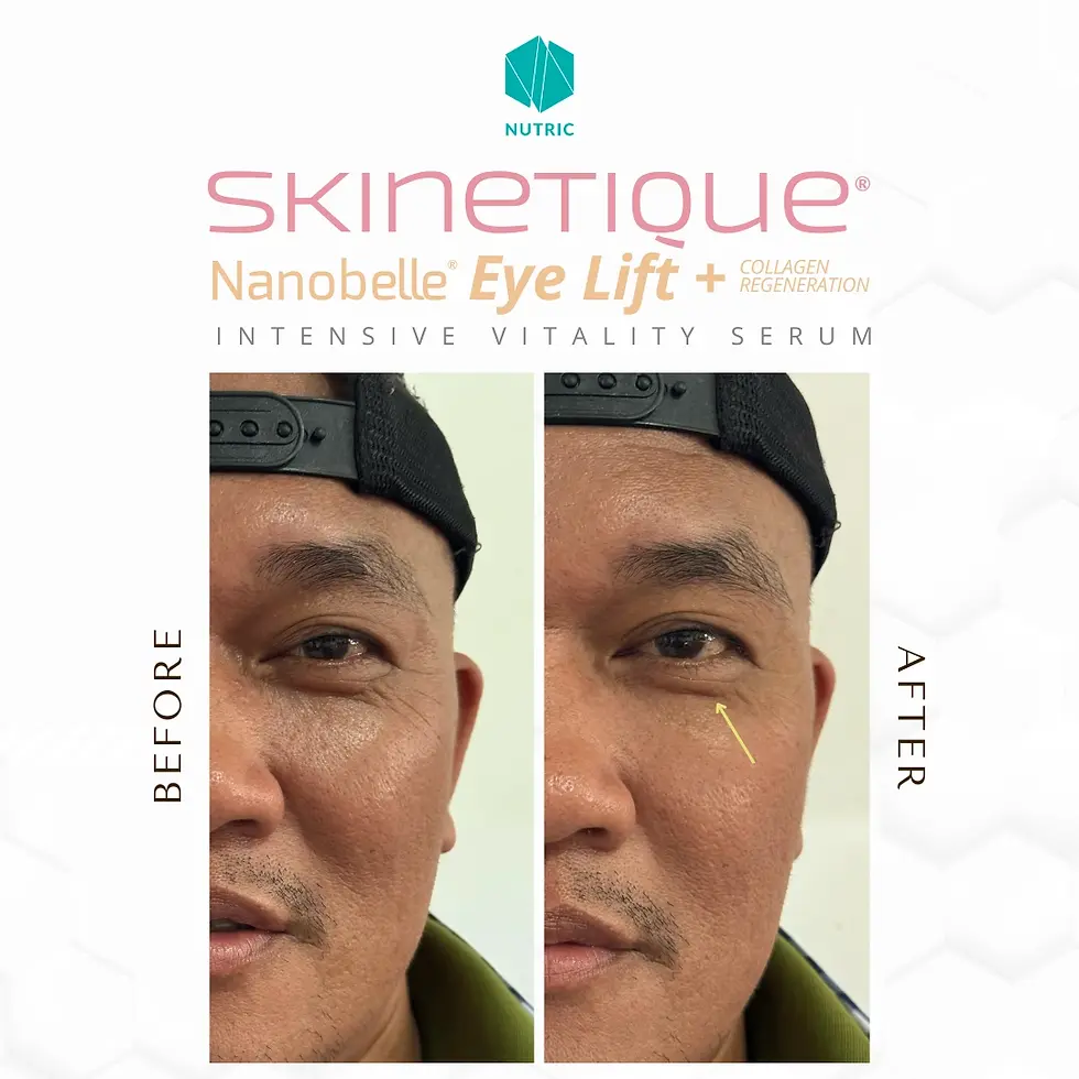 Skinetique Nanobelle - Before After Testimony