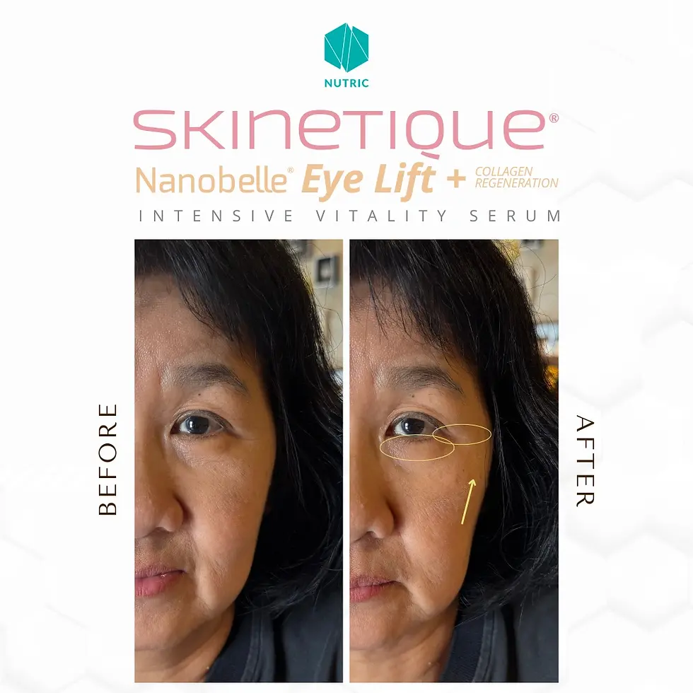 Skinetique Nanobelle - Before After Testimony