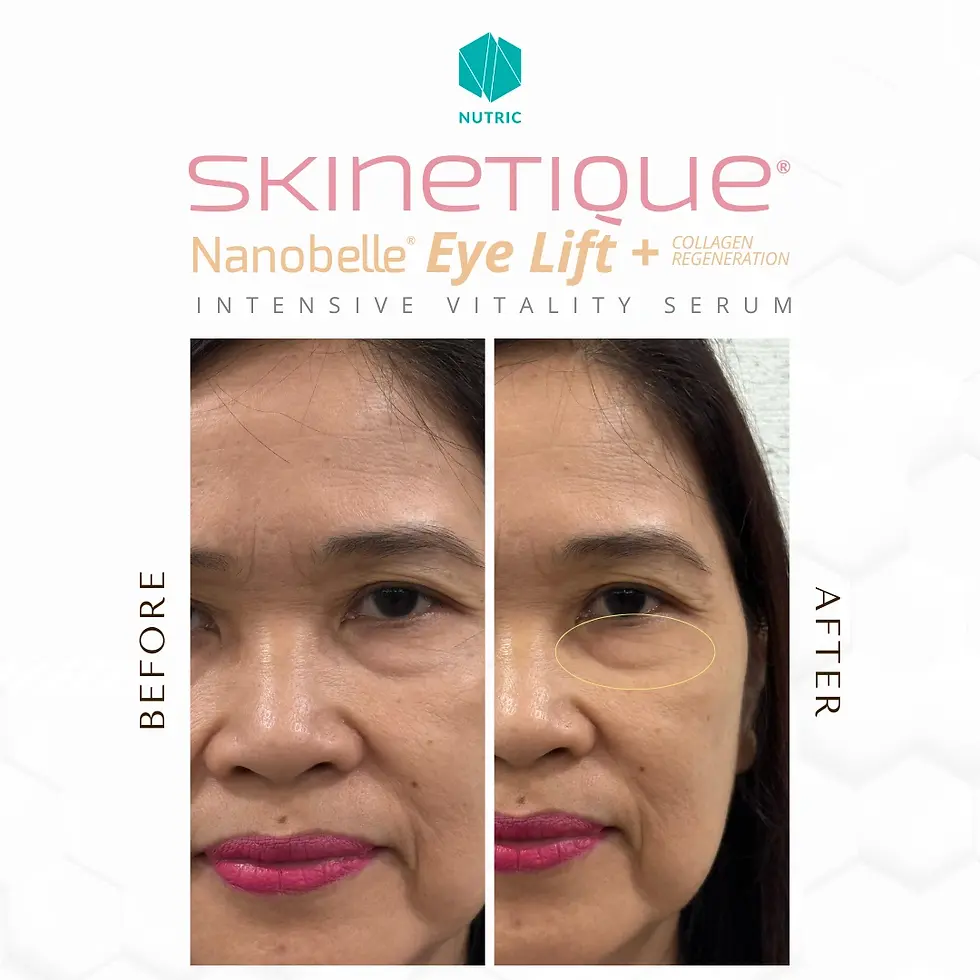Skinetique Nanobelle - Before After Testimony