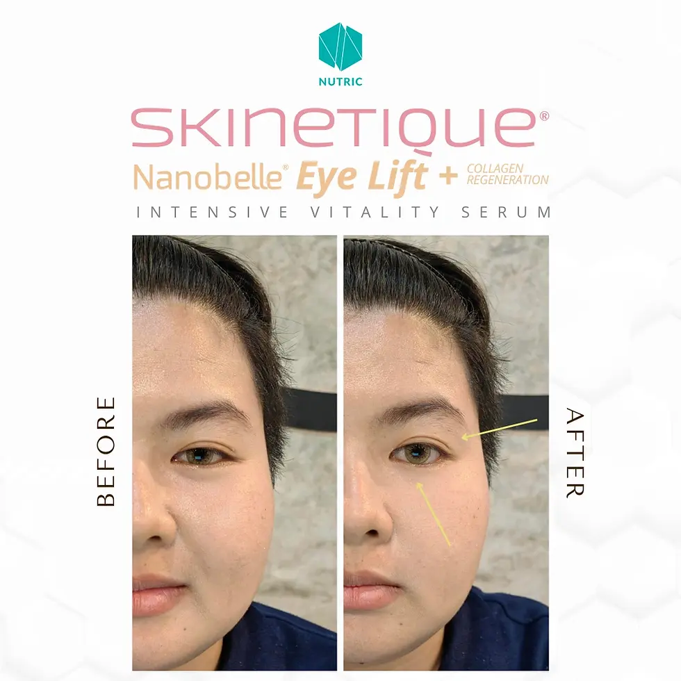 Skinetique Nanobelle - Before After Testimony