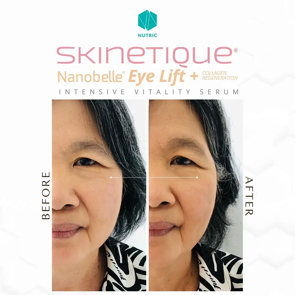 Skinetique Nanobelle - Before After Testimony