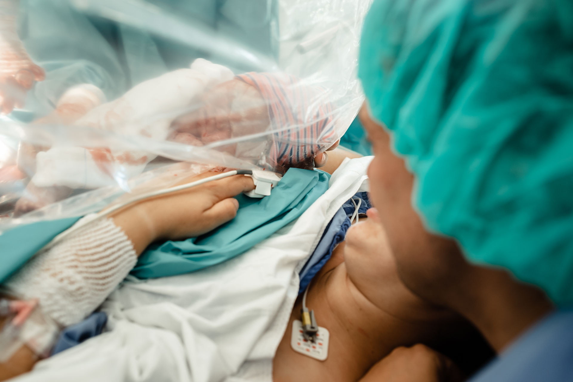c- section