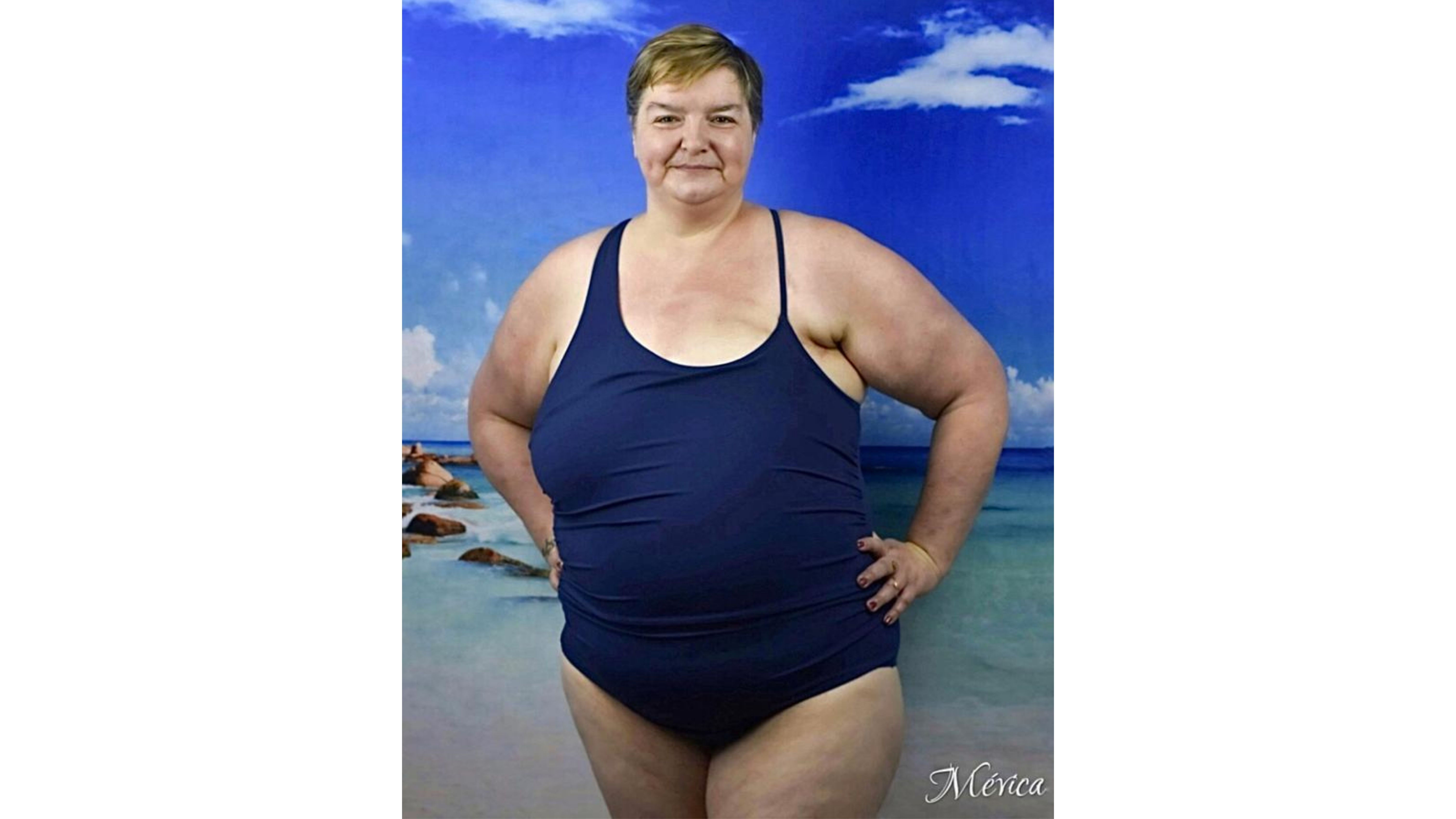 Maillot de bain une pièce mastectomie gauche