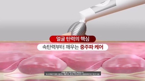 인서트 [EMS 브이쎄라] 인포