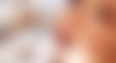 Kaip išvengti periodontito?